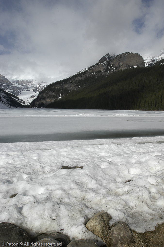    Lake Louise, Banff National Park, Albert, Canada